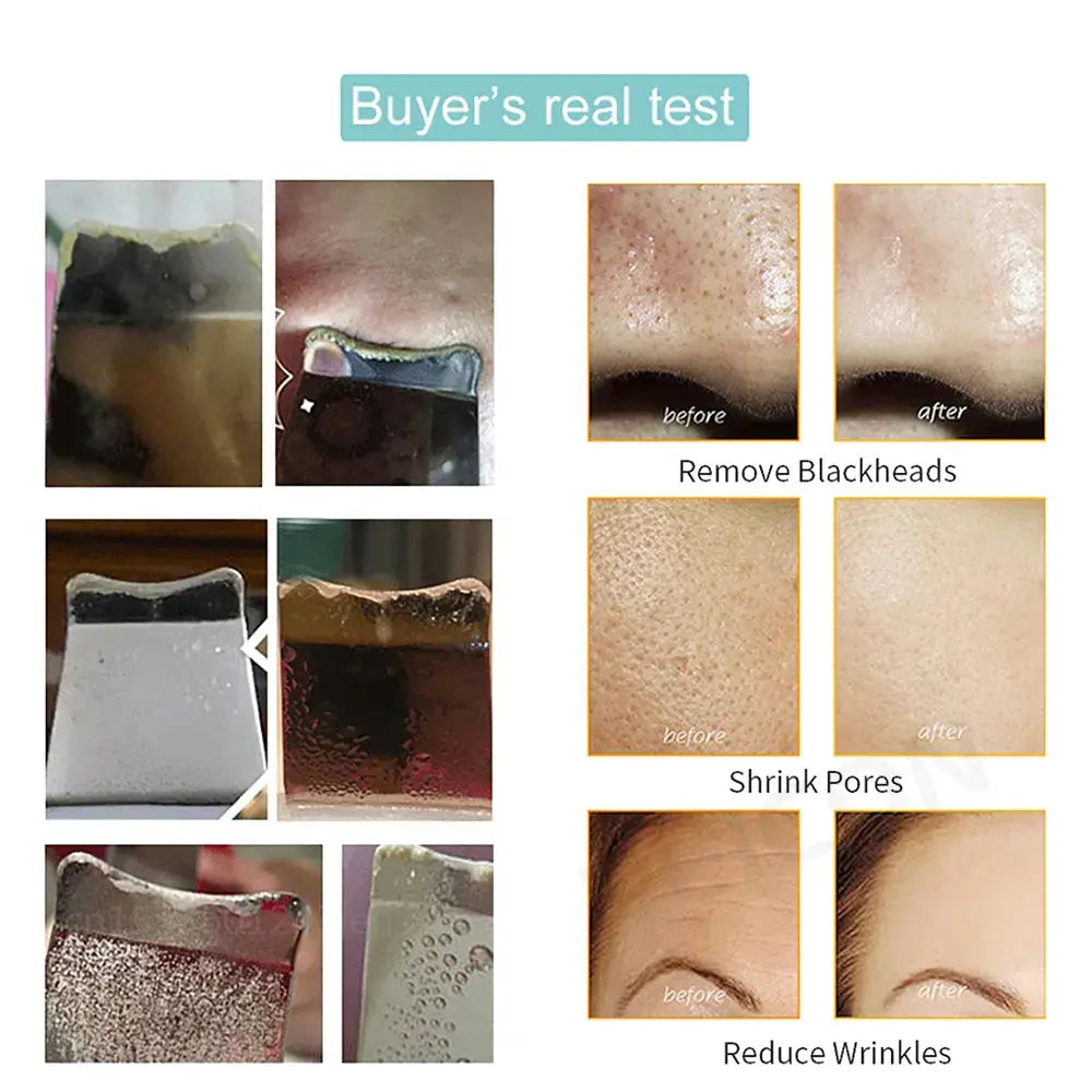 Ultrasonic Skin Scrubber: Peeling, Blackhead Remover & Tiefenreinigung - Raffiniertedinge Ultrasonic Skin Scrubber: Peeling, Blackhead Remover & Tiefenreinigung - Raffiniertedinge